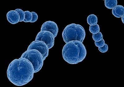 掌握如下的方法，從此蛋白表達不用愁