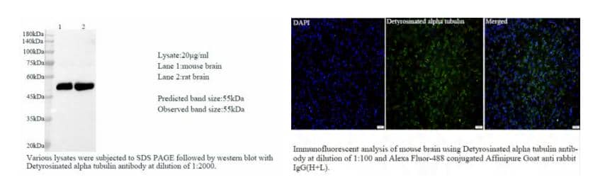 兔單克隆抗體在橫紋肌溶解相關急性腎損傷中的潛在應用